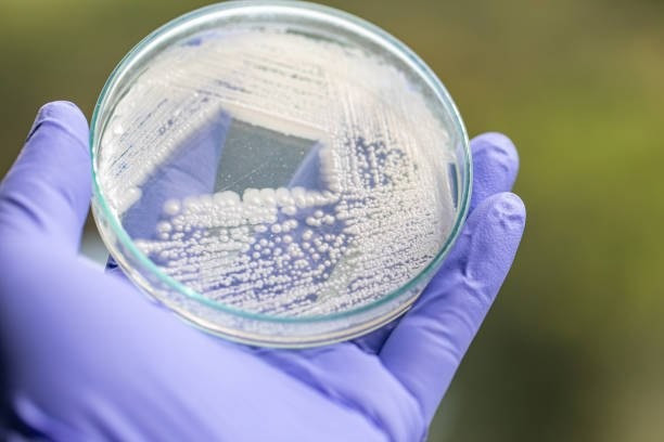 Estonian Startup ÄIO Turns Sawdust into Food-Grade Fat via Precision Fermentation Estonian Startup ÄIO Turns Sawdust into Food-Grade Fat via Precision Fermentation