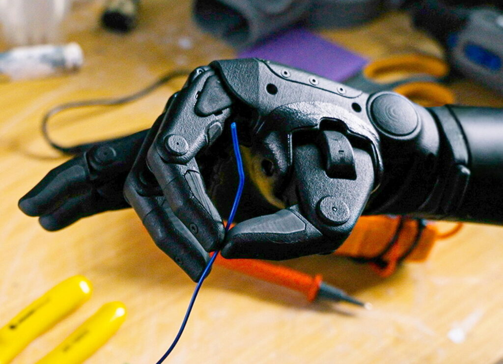 Bronx Physicist Becomes First Recipient Of Advanced 3D-Printed Robotic Arm