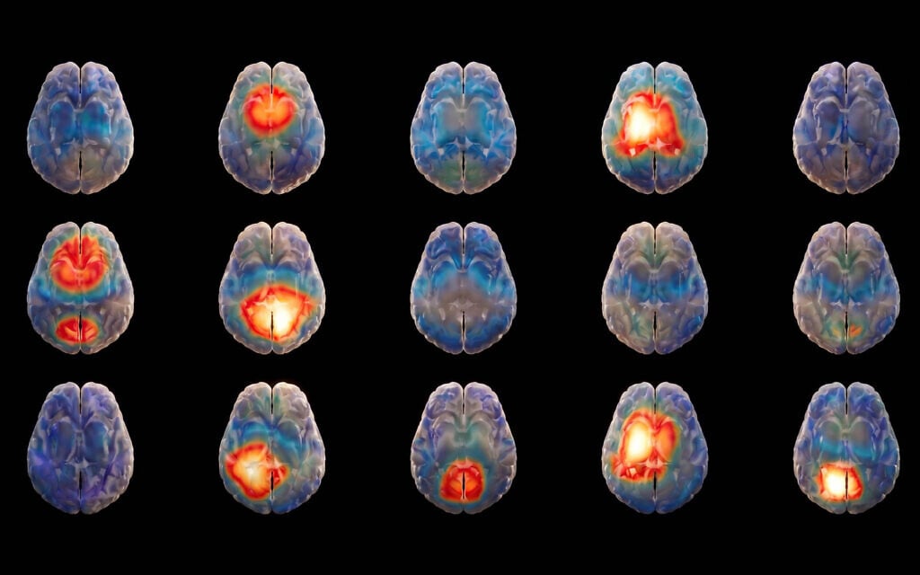 Brain-Decoding AI Startup Seeks to Translate the Brain’s Electrical Language