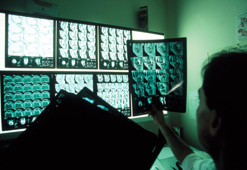 AI Accelerates Search for Answers in Rare Medical Cases